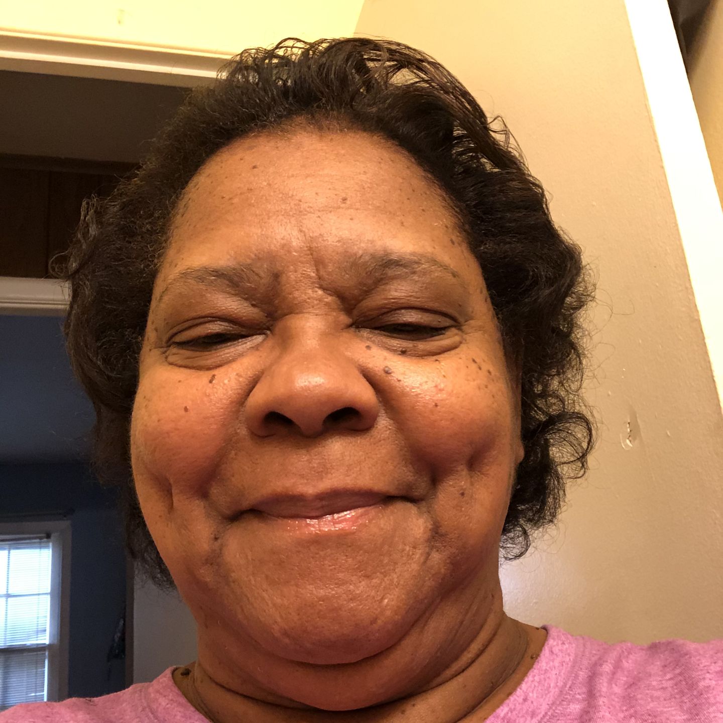 Customer photo review of Super G  Vital Growth Serum Water-based scalp serum infused with white willow bark