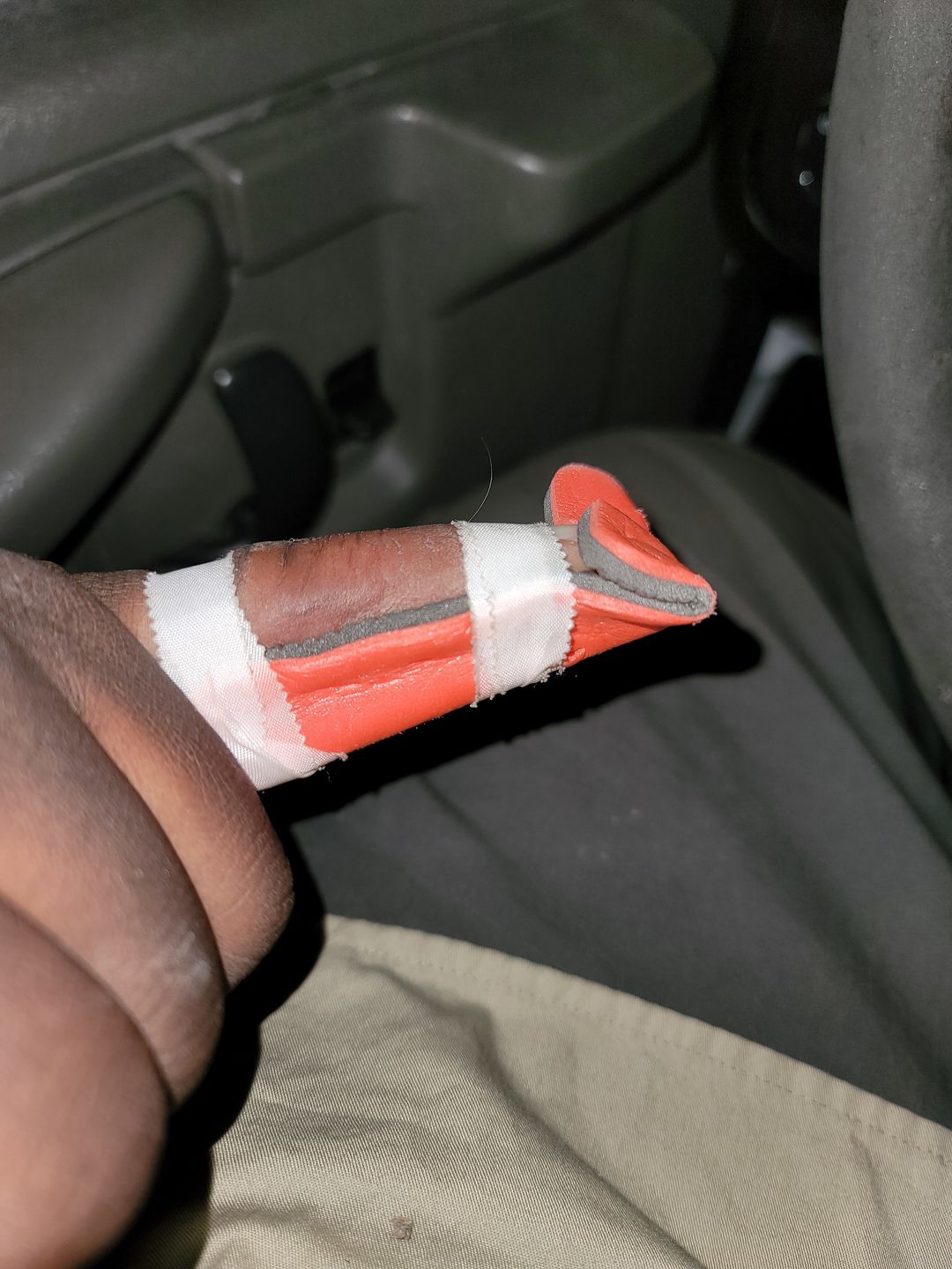 Customer photo review of ActiSplint Finger - 10 Pack