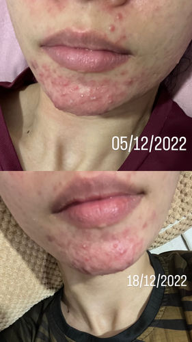 Customer photo review of Night Repair Creme