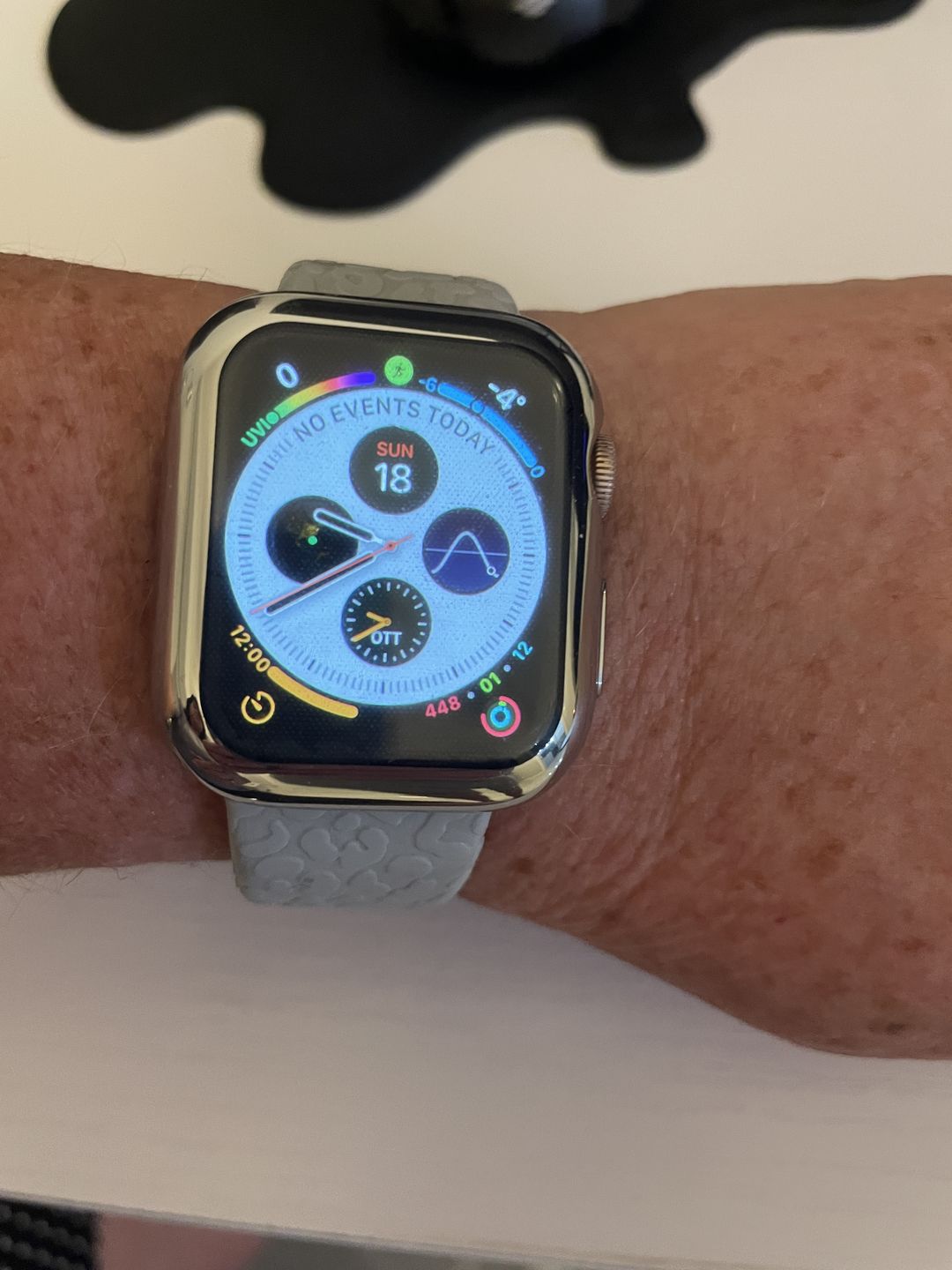 Customer photo review of Aegis Silicone Watch Case