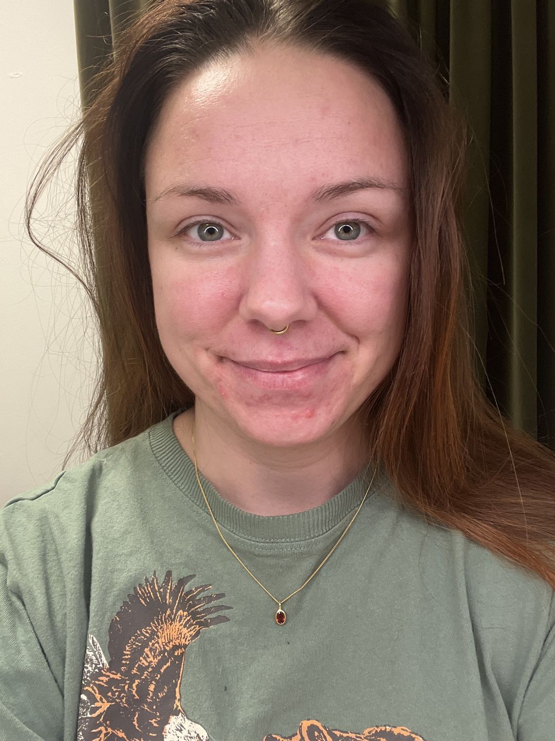 Customer photo review of Guldkedja Curb