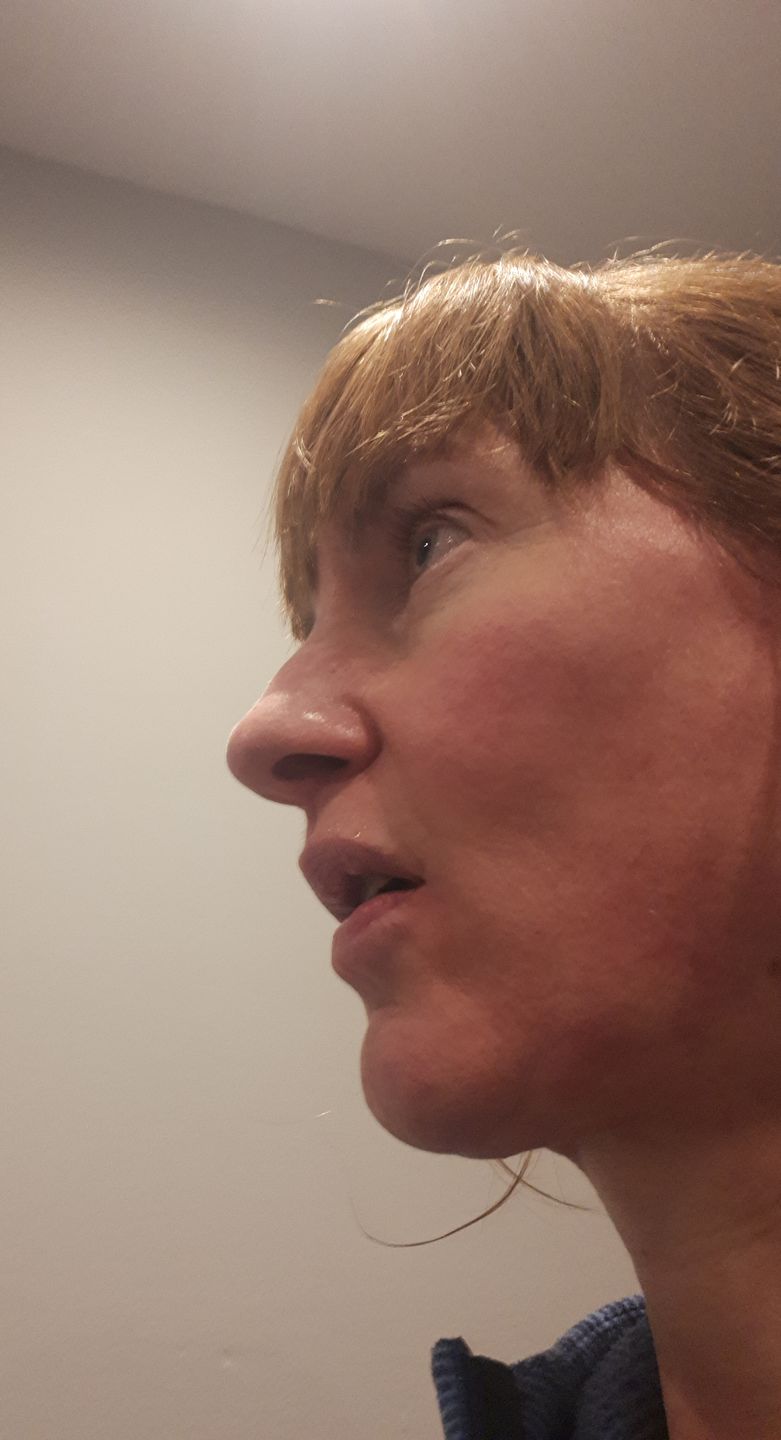Customer photo review of Repair & Renew Cream