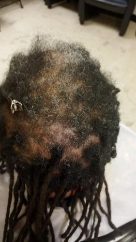 Customer photo review of Holistic Scalp Cream