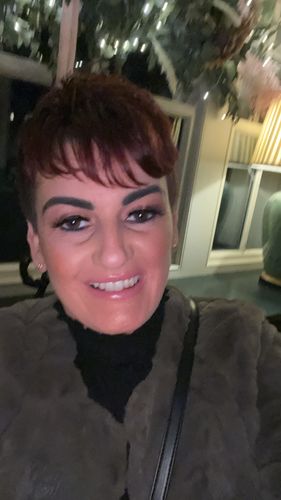 Customer photo review of LashAura™ - Premium Eyelash Kit (60% OFF)