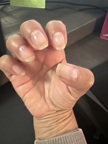 Customer photo review of Rocket Nail Fuel Nail Repair - Clear