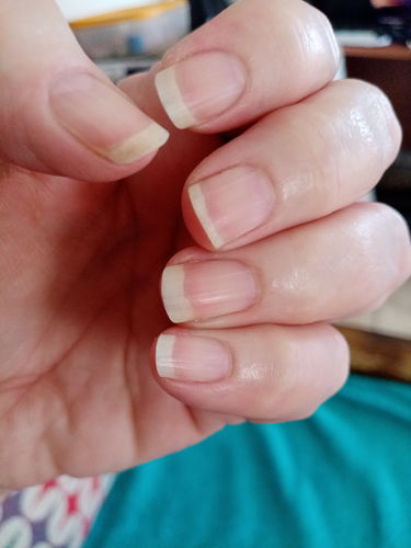 Customer photo review of Hair & Nail Herbs Tincture - Buy 1 Get 1 Free Offer