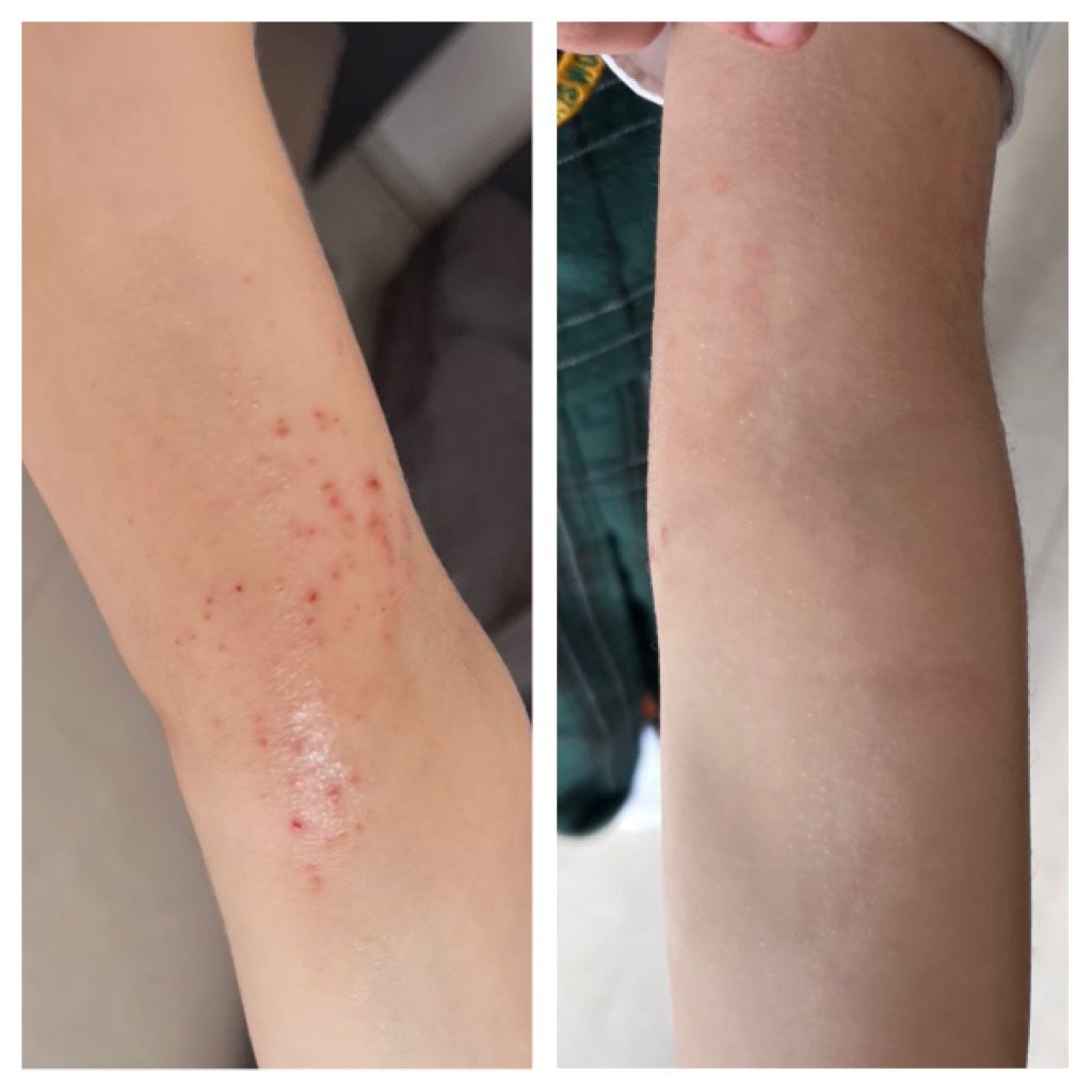 Customer photo review of Organic Barrier Balm