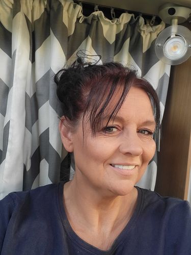 Customer photo review of Teeth-Veneer 2.0