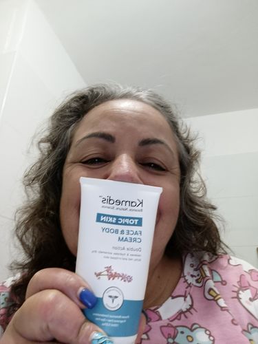 Customer photo review of קרם לחות טיפולי לעור יבש עד יבש במיוחד | TOPIC FACE & BODY CREAM