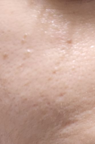 Customer photo review of Night Repair Creme