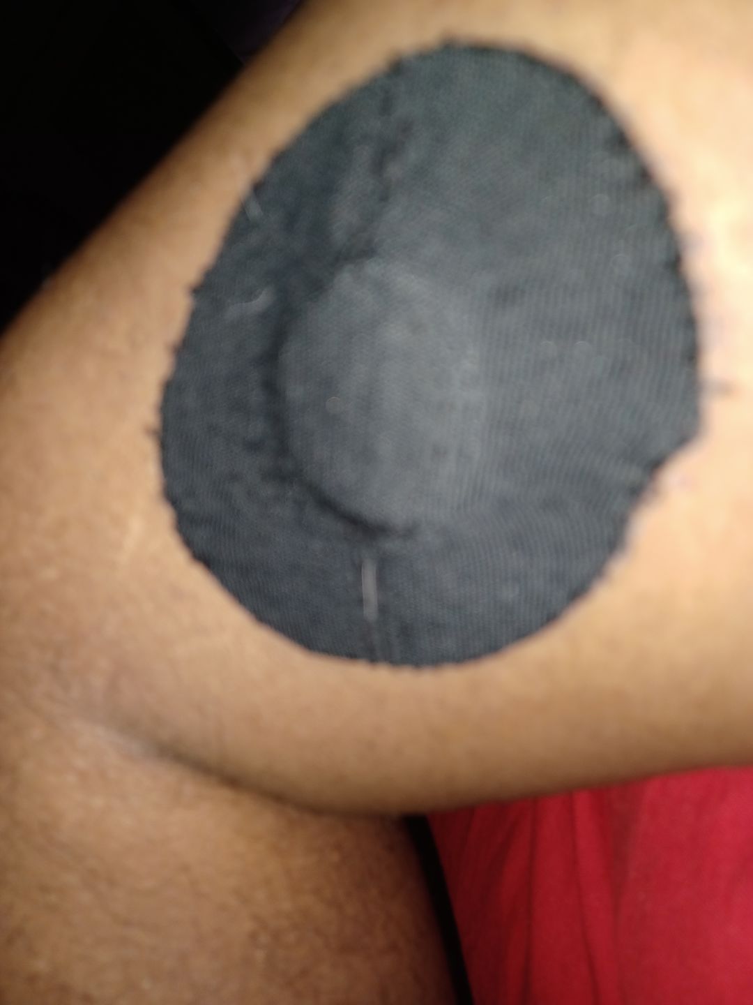 Customer photo review of Skin Grip Original - Freestyle Libre Adhesive Patches