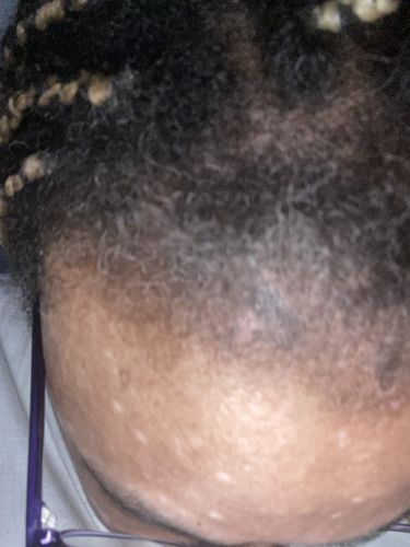 Customer photo review of Honey & Watermelon Infusion - Ultimate Moisture Leave-in Conditioner
