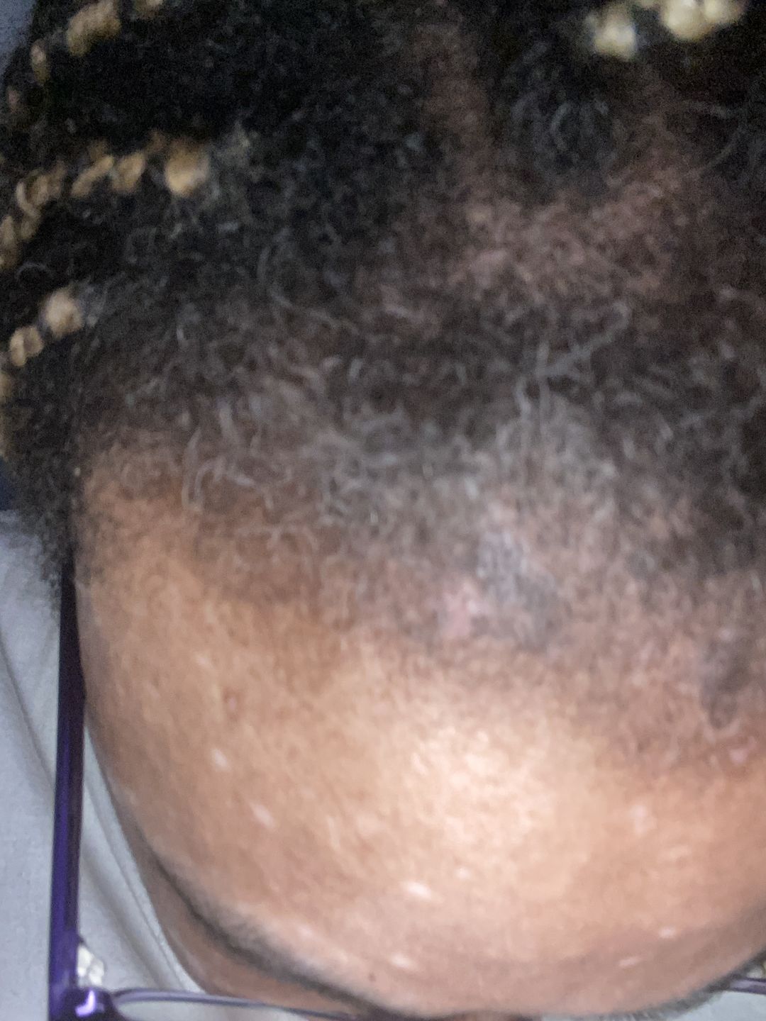 Customer photo review of Honey & Watermelon Infusion - Ultimate Moisture Leave-in Conditioner