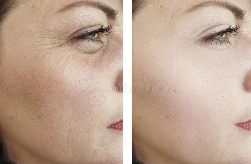 Customer photo review of Wrinkle Facial Serum with A, C & E