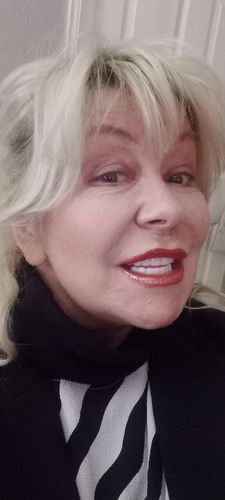 Customer photo review of Teeth-Veneer 2.0