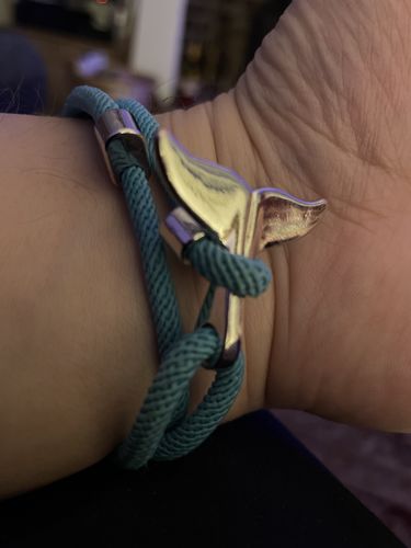 Customer photo review of "Whale" tracking bracelet