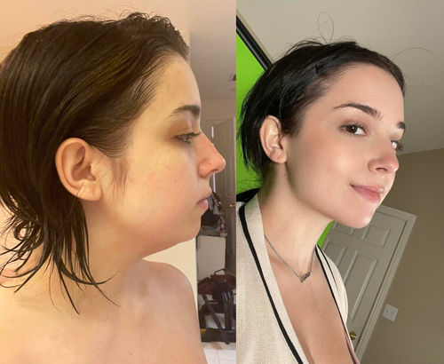 Customer photo review of SmalMästare™ Magnetisk Terapi Bantning Nackstöd