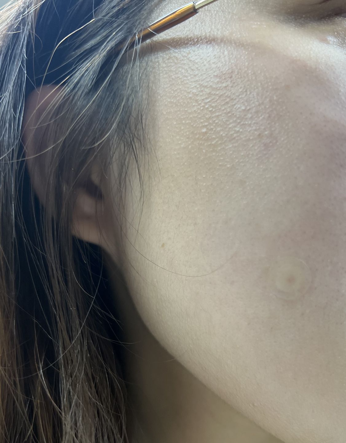 Customer photo review of Dr. wonder Wonder Patch