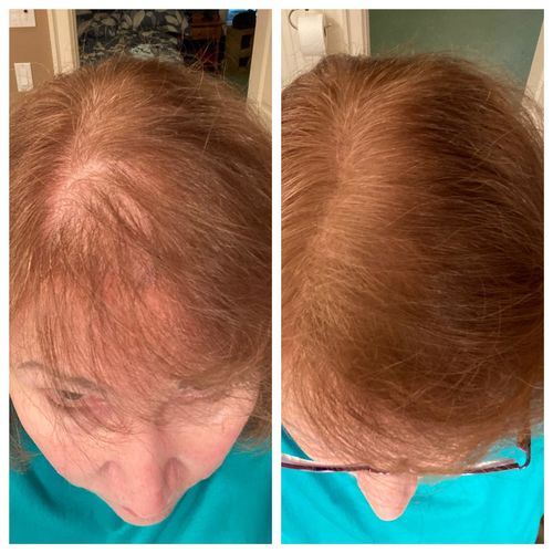 Customer photo review of CoverUp™ Omedelbar Hårskuggpulver
