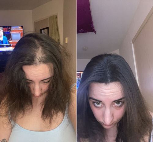 Customer photo review of CoverUp™ Omedelbar Hårskuggpulver