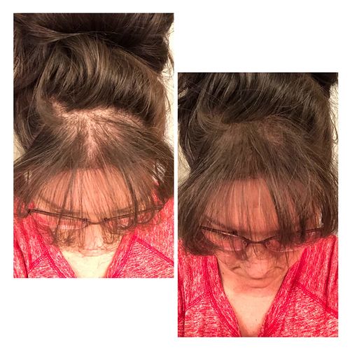 Customer photo review of CoverUp™ Omedelbar Hårskuggpulver