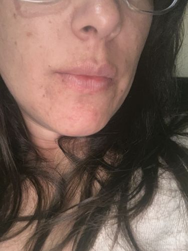 Customer photo review of Naturaloe Crema Hidratante Día 50ml