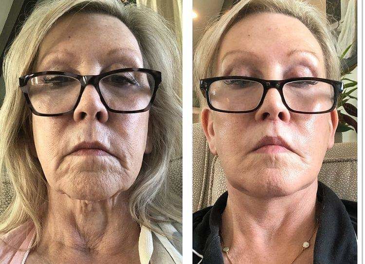 Customer photo review of Super Anti-Aging serum