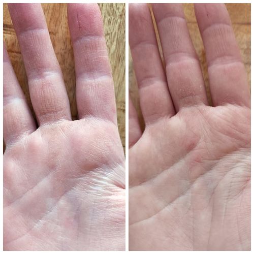 Customer photo review of AgeRewind™ Mango Närande Handkräm