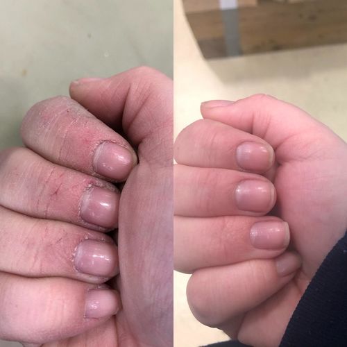 Customer photo review of AgeRewind™ Mango Närande Handkräm