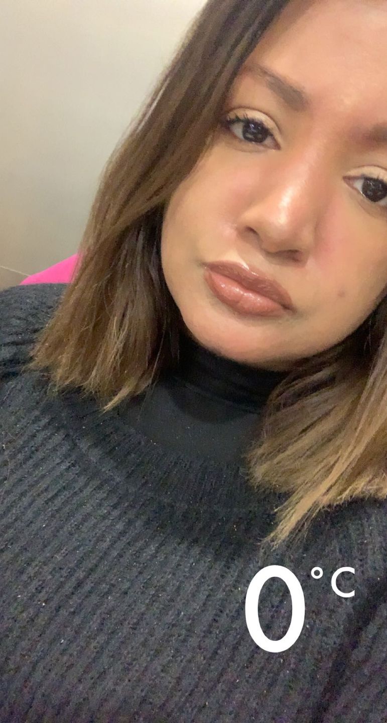 Customer photo review of Good Skin - 1 mois