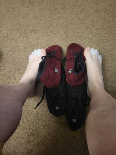 Customer photo review of Correct Toes®