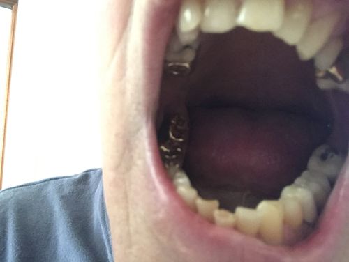 Customer photo review of Nano Silver Single Tube - 4oz