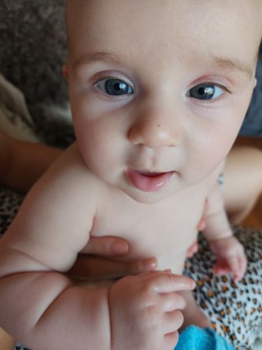 Customer photo review of 24 Pack of Probiotic Baby Wipes