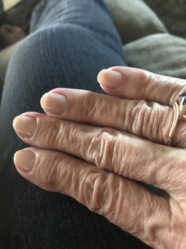 Customer photo review of Rocket Nail Fuel Nail Repair - Clear