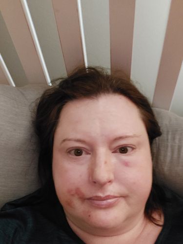 Customer photo review of Gut Maintain - 2 Months Supply (Free)