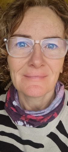 Customer photo review of Rosalique 3 in 1 Anti-Redness Miracle Formula SPF50