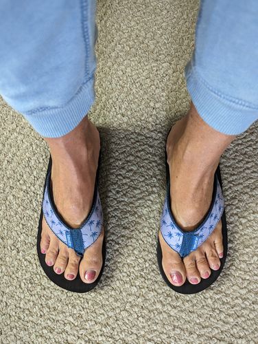 Customer photo review of Turtle Tie-dye