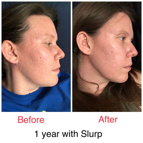 Customer photo review of Niacid