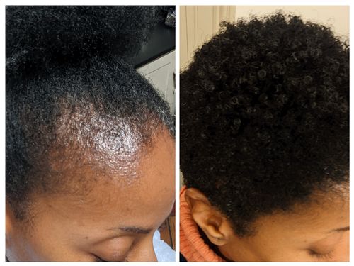 Customer photo review of Drizzle - Hydrating Mist