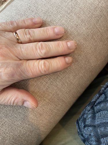 Customer photo review of Rocket Nail Fuel Nail Repair - Clear