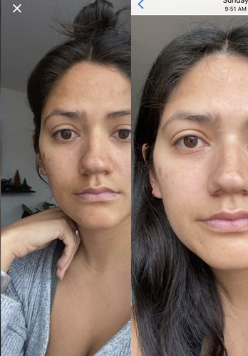 Customer photo review of The Face Set