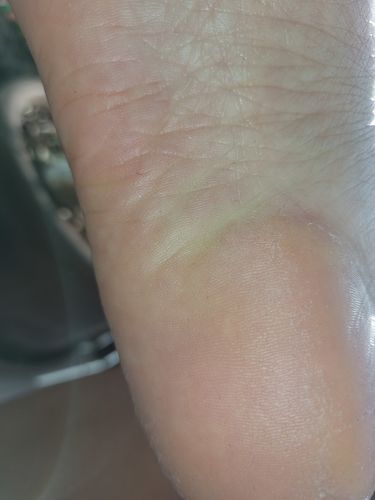 Customer photo review of LOVASKIN COCOONING DUO - Instant Foot Peel 75 ml with Instant Moisturizer 50 ml