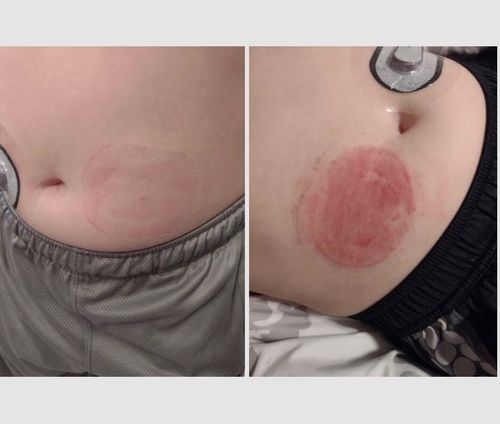 Customer photo review of Underlayer by FlexiArmor