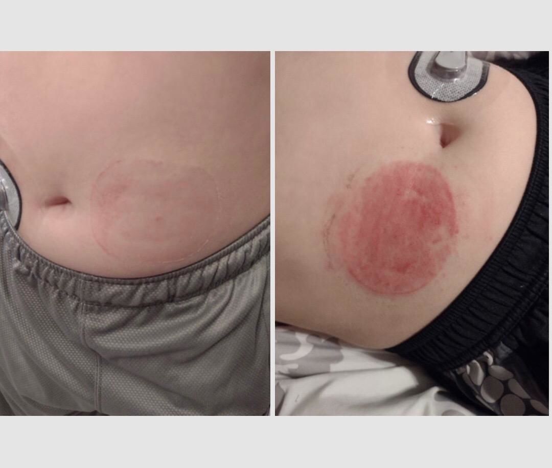 Customer photo review of Underlayer by FlexiArmor