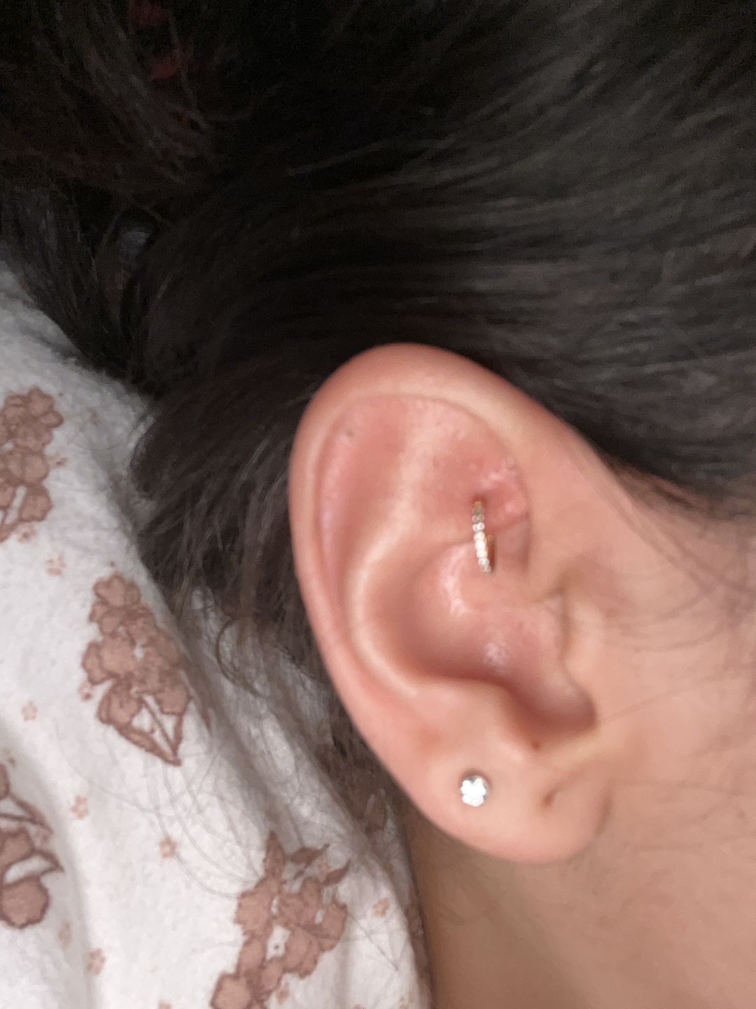 Customer photo review of Zircon Clicker | Nasen- & Ohrpiercing