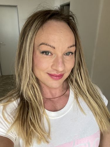 Customer photo review of Full Shine Lace Human Hair Wig Toppers 13cm*13cm For Women Hair Loss Balayage #3/8/22