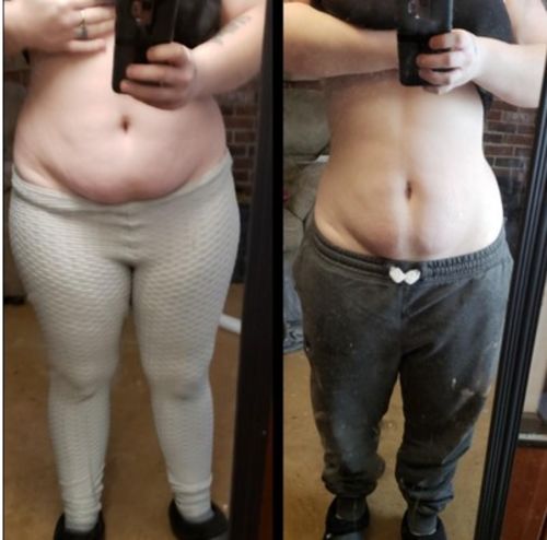 Customer photo review of SmalMästare™ Magnetisk Terapi Avsmalnande Handledsstöd