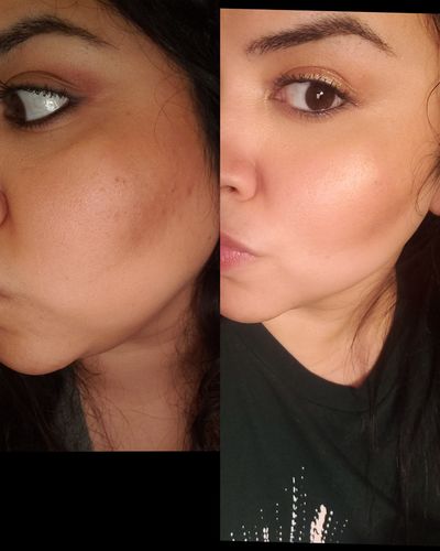 Customer photo review of RynkFri™ Ögonkräm Applikator & Massagepinne