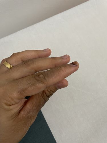 Customer photo review of Jolicare Cream