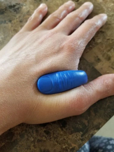 Customer photo review of AkupressAvlastning™ Akupressur Smärtlindring Fingerklämma